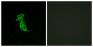 GPR143 Antibody - Immunofluorescence analysis of LOVO cells, using GPR143 Antibody. The picture on the right is blocked with the synthesized peptide.