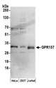GPR157 Antibody - Detection of human GPR157 by western blot. Samples: Whole cell lysate (50 µg) from HeLa, HEK293T, and Jurkat cells prepared using RIPA lysis buffer. Antibodies: Affinity purified rabbit anti-GPR157 antibody used for WB at 0.1 µg/ml. Detection: Chemiluminescence with an exposure time of 3 minutes.