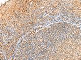 GPR161 Antibody - Immunohistochemistry of paraffin-embedded Human tonsil tissue  using GPR161 Polyclonal Antibody at dilution of 1:40(×200)