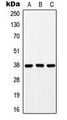 GPR171 Antibody - Western blot analysis of GPR171 expression in HEK293T (A); mouse liver (B); rat liver (C) whole cell lysates.