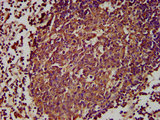 GPR174 Antibody - Immunohistochemistry Dilution at 1:300 and staining in paraffin-embedded human lymph node tissue performed on a Leica BondTM system. After dewaxing and hydration, antigen retrieval was mediated by high pressure in a citrate buffer (pH 6.0). Section was blocked with 10% normal Goat serum 30min at RT. Then primary antibody (1% BSA) was incubated at 4°C overnight. The primary is detected by a biotinylated Secondary antibody and visualized using an HRP conjugated SP system.