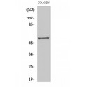 GPR176 Antibody - Western blot of GPR176 antibody