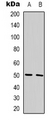 GPR180 Antibody - Western blot analysis of GPR180 expression in Jurkat (A); HEK293T (B) whole cell lysates.