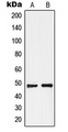 GPR19 Antibody - Western blot analysis of GPR19 expression in MCF7 (A); Raji (B) whole cell lysates.