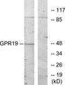 GPR19 Antibody - Western blot analysis of extracts from HeLa cells, using GPR19 antibody.