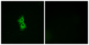 GPR22 Antibody - Immunofluorescence analysis of MCF7 cells, using GPR22 Antibody. The picture on the right is blocked with the synthesized peptide.