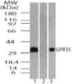 GPR35 Antibody - Western blot of ug Protein-Coupled Receptor GPR35 in MCF7 cell lysate in the 1) absence and 2) presence of immunizing peptide 3) RAW using Polyclonal Antibody to G Protein-Coupled Receptor GPR35 at 0.5 ug/ml and 1.0 ug/ml, respectively.