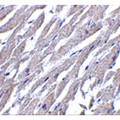 GPR44 / CRTH2 Antibody - Immunohistochemistry of CRTH2 in human heart tissue with CRTH2 antibody at 2.5 µg/mL.