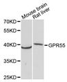 GPR55 Antibody - Western blot analysis of extracts of various cell lines, using GPR55 antibody at 1:3000 dilution. The secondary antibody used was an HRP Goat Anti-Rabbit IgG (H+L) at 1:10000 dilution. Lysates were loaded 25ug per lane and 3% nonfat dry milk in TBST was used for blocking. An ECL Kit was used for detection and the exposure time was 90s.