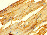 GPR82 Antibody - Immunohistochemistry of paraffin-embedded human skeletal muscle tissue using GPR82 Antibody at dilution of 1:100