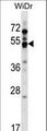 GPR84 Antibody - GPR84 Antibody western blot of WiDr cell line lysates (35 ug/lane). The GPR84 antibody detected the GPR84 protein (arrow).