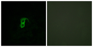 GPR87 Antibody - Immunofluorescence analysis of HUVEC cells, using GPR87 Antibody. The picture on the right is blocked with the synthesized peptide.