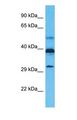 GPRC5C Antibody - Western blot of GPRC5C Antibody with human Jurkat Whole Cell lysate.  This image was taken for the unconjugated form of this product. Other forms have not been tested.