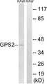 GPS2 Antibody - Western blot analysis of lysates from RAW264.7 cells, using GPS2 Antibody. The lane on the right is blocked with the synthesized peptide.