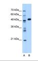 GPT / Alanine Transaminase Antibody - Lane A: Marker. Lane B: Transfected 293T cell lysate. Antibody concentration: 1.25 ug/ml. Gel concentration: 12%.  This image was taken for the unconjugated form of this product. Other forms have not been tested.