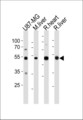 GPT / Alanine Transaminase Antibody - GPT Antibody (N-term R133) western blot of U87-MG cell line , mouse liver ,and rat heart and liver tissue lysates (35 ug/lane). The GPT antibody detected the GPT protein (arrow).