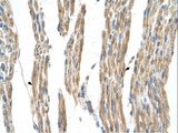 GPT / Alanine Transaminase Antibody - GPT / ALT1 antibody GPT(glutamic-pyruvate transaminase (alanine aminotransferase)) Antibody was used in IHC to stain formalin-fixed, paraffin-embedded human muscle.  This image was taken for the unconjugated form of this product. Other forms have not been tested.