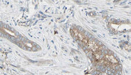 GPX1 / Glutathione Peroxidase Antibody - 1:100 staining human prostate tissue by IHC-P. The sample was formaldehyde fixed and a heat mediated antigen retrieval step in citrate buffer was performed. The sample was then blocked and incubated with the antibody for 1.5 hours at 22°C. An HRP conjugated goat anti-rabbit antibody was used as the secondary.