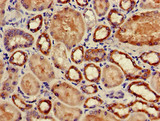 GPX4 / MCSP Antibody - Immunohistochemistry of paraffin-embedded human kidney tissue using GPX4 Antibody at dilution of 1:100
