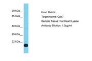 GPX7 Antibody -  This image was taken for the unconjugated form of this product. Other forms have not been tested.