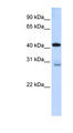 GRAMD2 Antibody - GRAMD2 antibody Western blot of Fetal Lung lysate. This image was taken for the unconjugated form of this product. Other forms have not been tested.