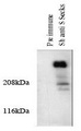 Gravin / AKAP12 Antibody - Western blotting total cellular protein from cultured rat aortic smooth muscle cells was prepared and analyze. The protein was transferred to a PVDF membrane, blocked 1XTBS, 0.1% tween 20/ 5%NFDM, probed with 5 g/ml of pre-immune serum 5 ug of SSeCKS – myristylated (PKC) substrate antibody (a 3 second exposure is shown). The blot was then washed and probed with monoclonal anti-sheep IgG coupled to HRP 1:10,000, and detected with luminol.