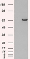 GRB7 Antibody - HEK293 overexpressing GRB7 (RC215362) and probed with (mock transfection in first lane).