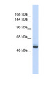 GREB1 Antibody - GREB1 antibody Western blot of Fetal Brain lysate. This image was taken for the unconjugated form of this product. Other forms have not been tested.