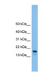 GREM2 / Gremlin 2 Antibody - GREM2 / Gremlin 2 antibody Western blot of 721_B cell lysate. This image was taken for the unconjugated form of this product. Other forms have not been tested.