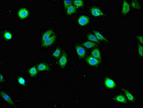 GRHL3 Antibody - Immunofluorescent analysis of PC-3 cells using GRHL3 Antibody at dilution of 1:100 and Alexa Fluor 488-congugated AffiniPure Goat Anti-Rabbit IgG(H+L)