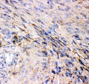 GRIA1 / GLUR1 Antibody - GRIA1 antibody IHC-paraffin: Human Meningioma Tissue.