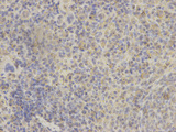 GRIA3 / GLUR3 Antibody - Immunohistochemistry of paraffin-embedded rat spleen using GRIA3 antibody at dilution of 1:200 (400x lens).