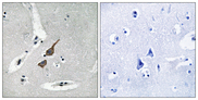 GRID1 Antibody - Immunohistochemistry analysis of paraffin-embedded human brain tissue, using GRID1 Antibody. The picture on the right is blocked with the synthesized peptide.
