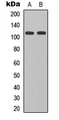 GRID2 Antibody - Western blot analysis of GLURD2 expression in HEK293T (A); mouse brain (B) whole cell lysates.