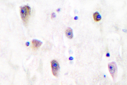 GRIK1 / GLUR5 Antibody - IHC of GluR5 (L12) pAb in paraffin-embedded human brain tissue.