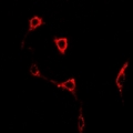 GRIK2 / GLUR6 Antibody - Immunofluorescent analysis of GLUR6 staining in U2OS cells. Formalin-fixed cells were permeabilized with 0.1% Triton X-100 in TBS for 5-10 minutes and blocked with 3% BSA-PBS for 30 minutes at room temperature. Cells were probed with the primary antibody in 3% BSA-PBS and incubated overnight at 4 deg C in a humidified chamber. Cells were washed with PBST and incubated with a DyLight 594-conjugated secondary antibody (red) in PBS at room temperature in the dark.
