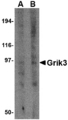 GRIK3 / GLUR7 Antibody - Western blot of Grik3 in human brain tissue lysate with Grik3 antibody at (A) 1 and (B) 2 ug/ml.