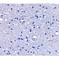 GRIK4 / KA1 Antibody - Immunohistochemical staining of human brain tissue using Grik4 antibody at 2.5 µg/mL.