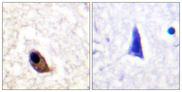 GRIN2A+GRIN2B Antibody - Immunohistochemistry analysis of paraffin-embedded human brain, using NMDAR2A/B (Phospho-Tyr1246/1252) Antibody. The picture on the right is blocked with the phospho peptide.