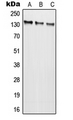 GRIN2C / NMDAR2C / NR2C Antibody - Western blot analysis of NMDAR2C expression in SKOVCAR (A); HEK293T (B); SP2/0 (C) whole cell lysates.