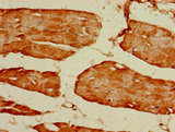 GRIN2C / NMDAR2C / NR2C Antibody - Immunohistochemistry of paraffin-embedded human skeletal muscle tissue using GRIN2C Antibody at dilution of 1:100