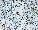 GRIPAP1 / GRASP1 Antibody - Immunohistochemical staining of paraffin-embedded endometrium tissue using anti-GRIPAP1 mouse monoclonal antibody. (Dilution 1:50).