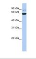 GRK5 Antibody - Fetal brain lysate. Antibody concentration: 1.0 ug/ml. Gel concentration: 12%.  This image was taken for the unconjugated form of this product. Other forms have not been tested.