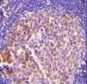 GRK6 Antibody - GRK6 Antibody immunohistochemistry of formalin-fixed and paraffin-embedded human tonsil tissue followed by peroxidase-conjugated secondary antibody and DAB staining.