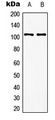 GRM8 / MGLUR8 Antibody - Western blot analysis of mGLUR8 expression in EOC20 (A); rat brain (B) whole cell lysates.