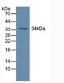 Growth Hormone Receptor / GHR Antibody - Western Blot; Sample: Human Lung Tissue.