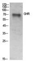 Growth Hormone Receptor / GHR Antibody - Western Blot analysis of extracts from SKOV3 cells using GHR Antibody.