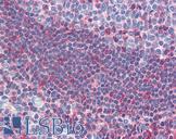 GSC / Goosecoid Antibody - Anti-GSC antibody IHC of human tonsil. Immunohistochemistry of formalin-fixed, paraffin-embedded tissue after heat-induced antigen retrieval. Antibody concentration 5 ug/ml.  This image was taken for the unconjugated form of this product. Other forms have not been tested.