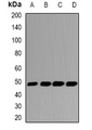 GSDMB / Gasdermin-Like Antibody - Western blot analysis of GSDML expression in HeLa (A); HT29 (B); mouse liver (C); rat liver (D) whole cell lysates.
