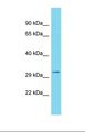 GSG1L Antibody - Western blot of Human Stomach Tumor. GSG1L antibody dilution 1.0 ug/ml.  This image was taken for the unconjugated form of this product. Other forms have not been tested.